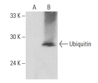 Ubiquitin (P4D1)