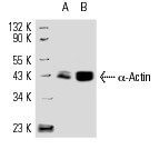 α-Actin (1A4)