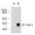 Fra-1 (B-10)