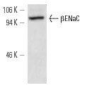 βENaC (E-10)