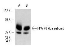 RPA 70 kDa subunit (H-7)