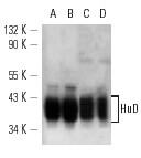 HuD (H-9)