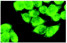 Smooth Muscle Actin (B4)