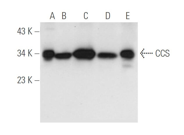 CCS (H-7): m-IgG Fc BP-HRP Bundle