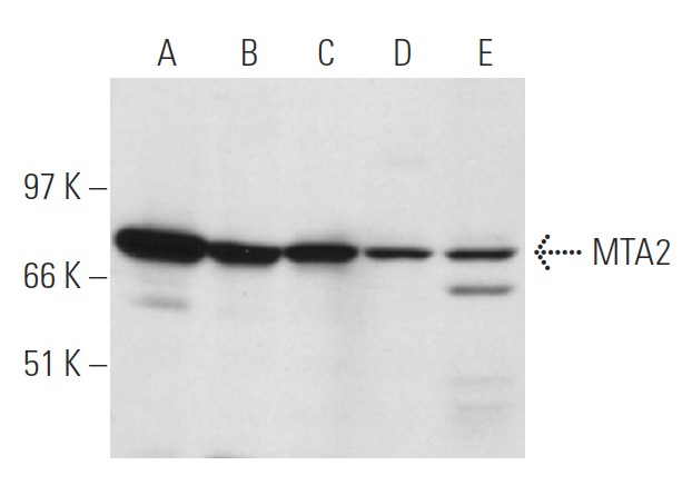 MTA2 (F-9): m-IgG Fc BP-HRP Bundle