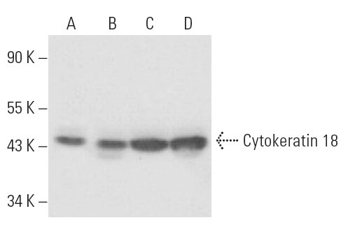 Cytokeratin 18 (B23.1.)