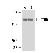 TFIID (1TBP18)