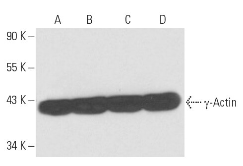 γ-Actin (1-17)