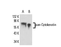 pan-Cytokeratin (HEP 111)