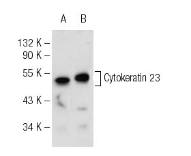 Cytokeratin 23 (C-1): m-IgG Fc BP-HRP Bundle