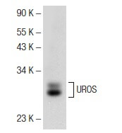 UROS (A-8): m-IgG Fc BP-HRP Bundle