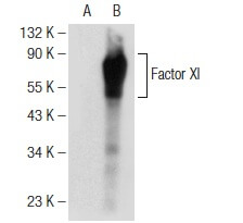 Factor XI (G-2): m-IgG Fc BP-HRP Bundle