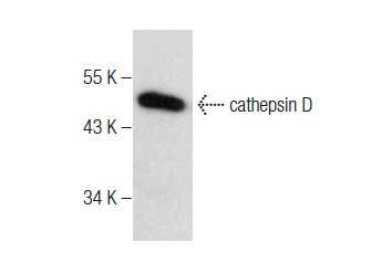 cathepsin D (D-7)