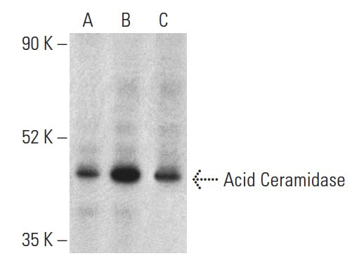 Acid Ceramidase (F-9): m-IgGκ BP-HRP Bundle