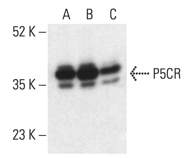 P5CR (A-12): m-IgG1 BP-HRP Bundle