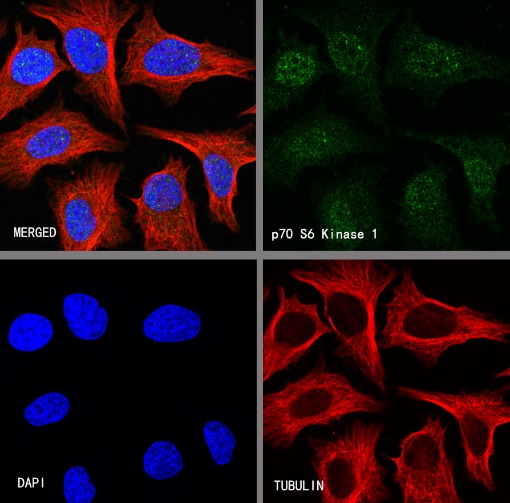 p70 S6 Kinase Recombinant Rabbit mAb (S-1278-2)