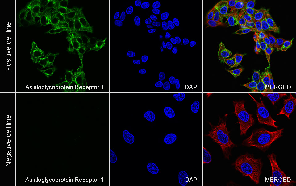Asialoglycoprotein Receptor 1 Recombinant Rabbit mAb (SDT-292-48)