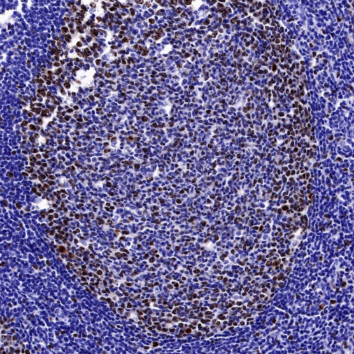 Ki67 Recombinant Mouse mAb (SDT-606-7)