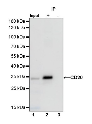 CD20 Recombinant Rabbit mAb,PBS Only (SDT-038-205)