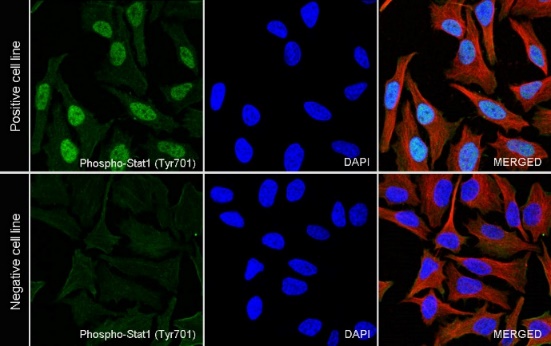 Phospho-Stat1 (Tyr701) Recombinant Rabbit mAb (S-601-78)