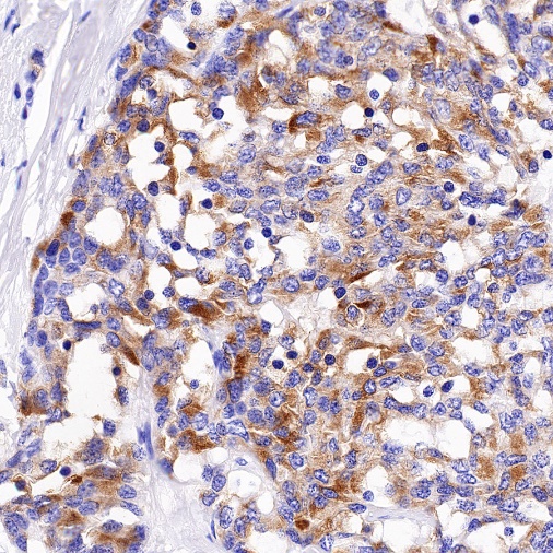 DLL3 Recombinant Rabbit mAb,PBS Only (S-207-179)