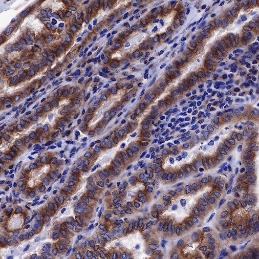 β-tubulin Recombinant Rabbit mAb (SDT-312-113)