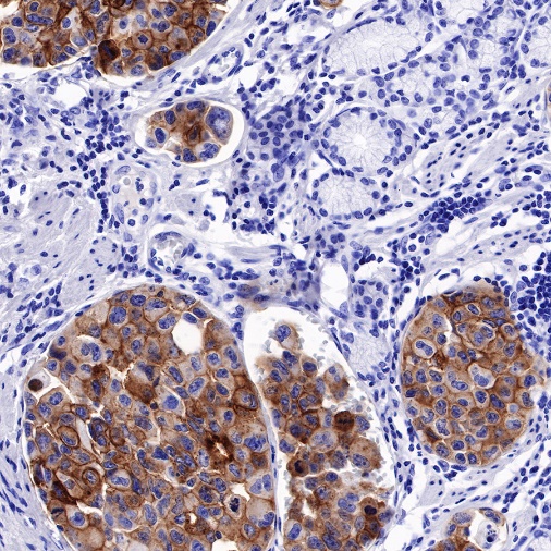 FGFR2b Recombinant Rabbit mAb (SDT-423-2)