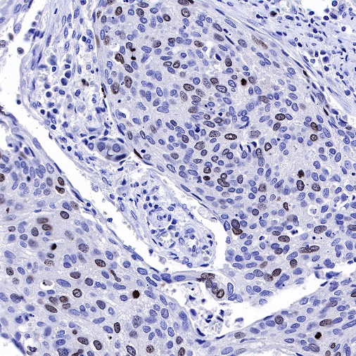 Ki67 Recombinant Mouse mAb,PBS Only (SDT-606-7)