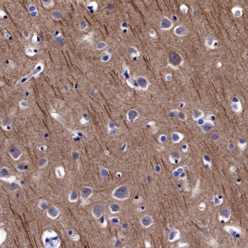 β-tubulin Recombinant Rabbit mAb (SDT-312-113)