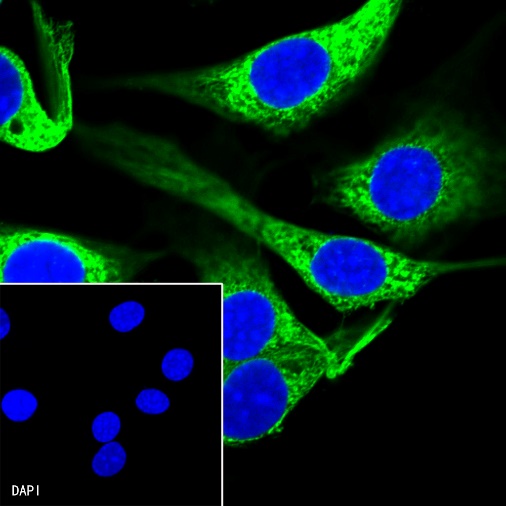 β-tubulin Recombinant Rabbit mAb (SDT-312-113)