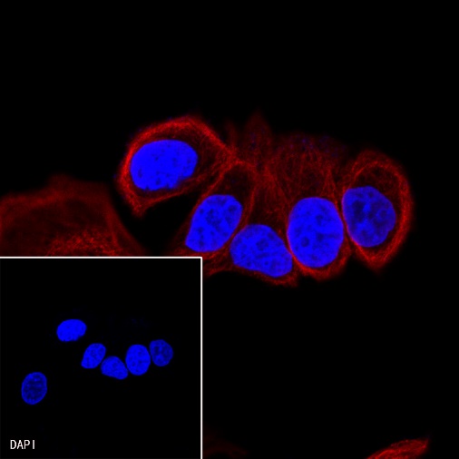 Goat anti-Rabbit IgG(H+L) (Alexa Fluor® 594 Conjugate)