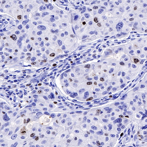 Ki67 Recombinant Mouse mAb (SDT-606-7)