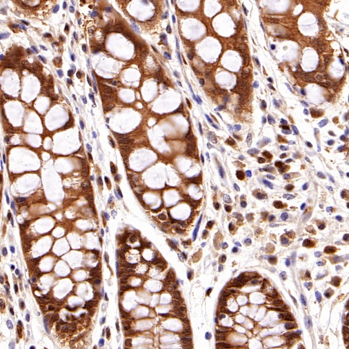 Caspase-3 Recombinant Rabbit mAb (S-493-3)