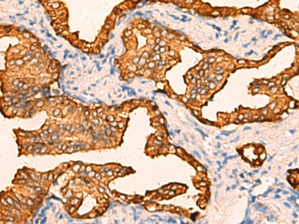 CRYM Polyclonal Antibody