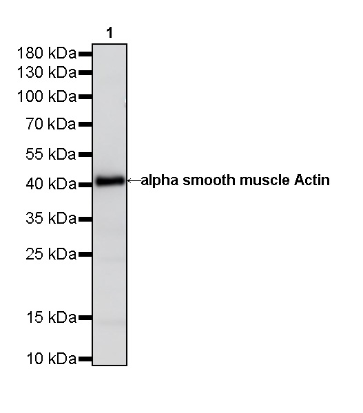 alpha smooth muscle Actin Recombinant Mouse mAb (SDT-R142)