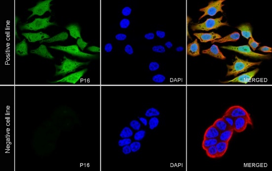 p16 Recombinant Rabbit mAb (SDT-303-206)