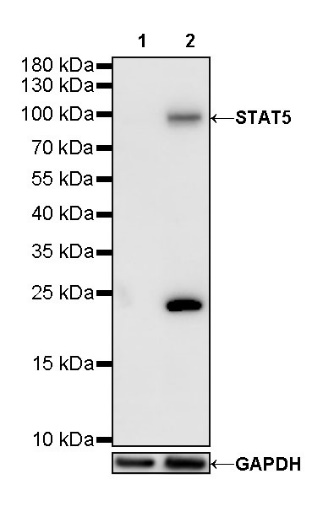 STAT5 Recombinant Rabbit mAb (S-R234)