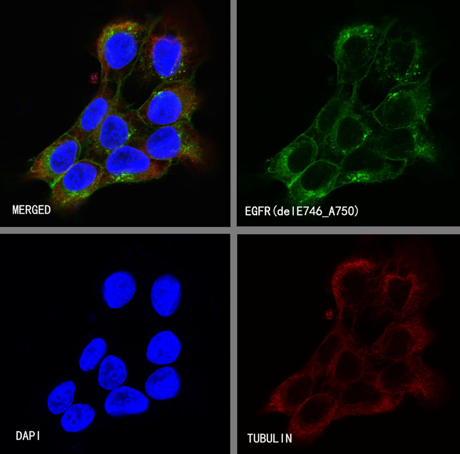EGFR (delE746-A750) Recombinant Rabbit mAb (S-451-168)