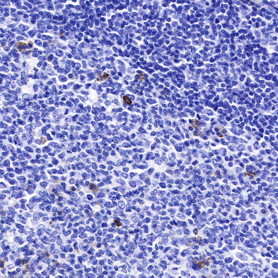 CD138 Recombinant Rabbit mAb (SDT-R120)