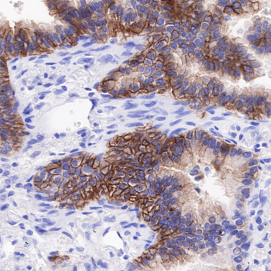 Claudin18.2 + Claudin18.1 Recombinant Rabbit mAb (SDT-298-29)