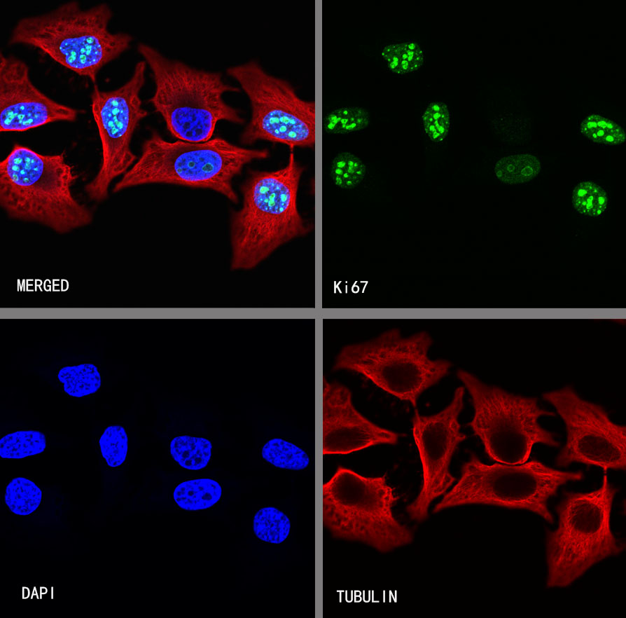 Ki67 Recombinant Mouse mAb,PBS Only (SDT-606-7)