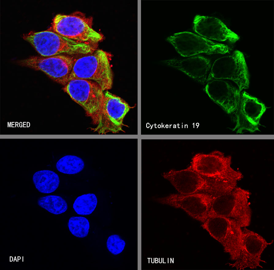 Rabbit anti-CytokeRatin 19 Recombiant Monoclonal Antibody(107-19)
