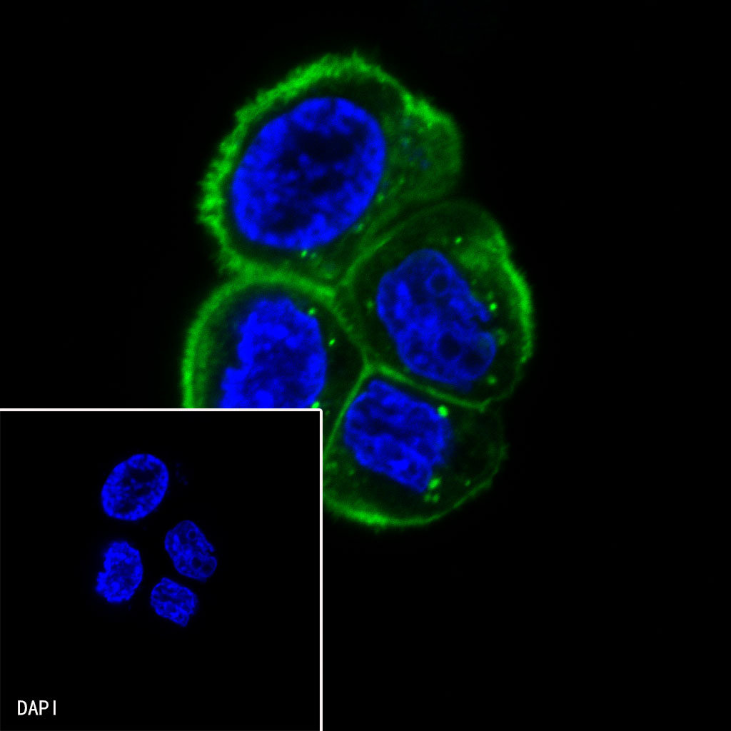 Claudin18.2 + Claudin18.1 Recombinant Rabbit mAb,PBS Only (SDT-298-29)