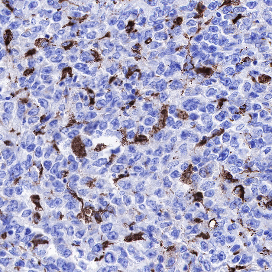 S-RMab® CD68 Recombinant Mouse mAb (SDT-R146)