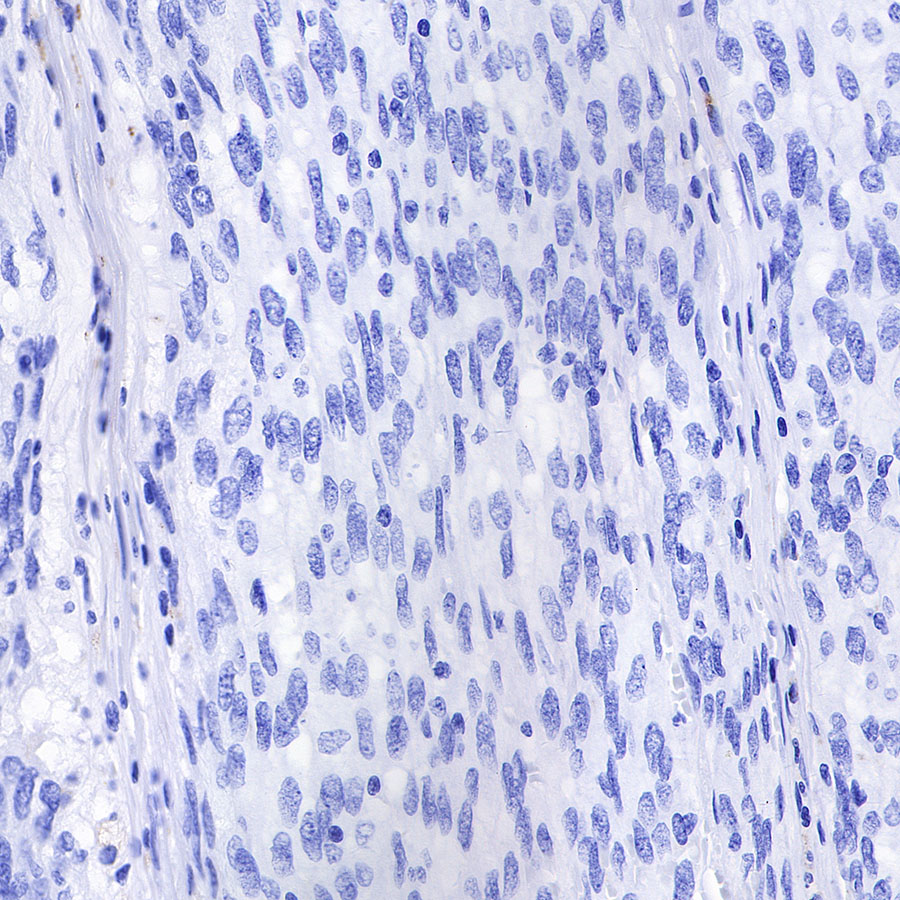 S-RMab® CD68 Recombinant Mouse mAb (SDT-R146)