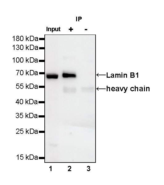 Lamin B1 Recombinant Rabbit mAb (SDT-307-108)