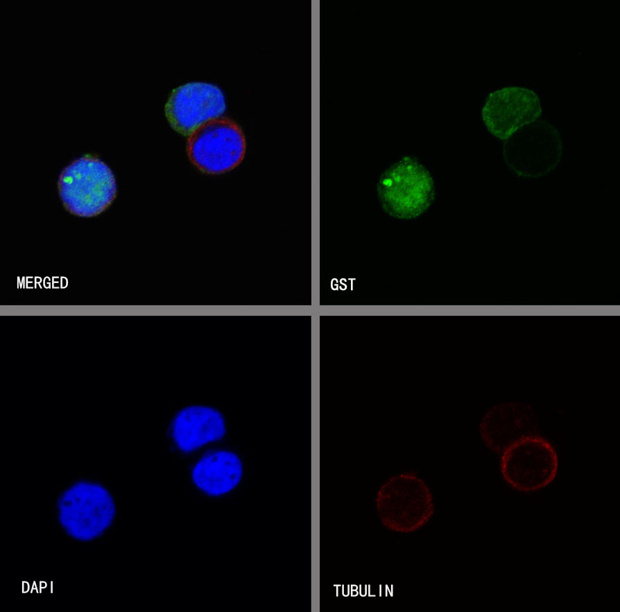 GST Tag Recombinant Rabbit mAb (S-372-19)