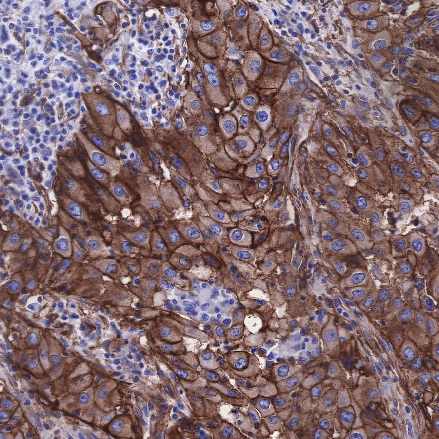 CD49b / Integrin alpha 2 Recombinant Rabbit mAb (SDT-399-52)