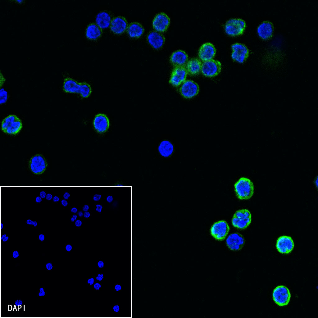 Mouse Anti-Human CD11a Antibody