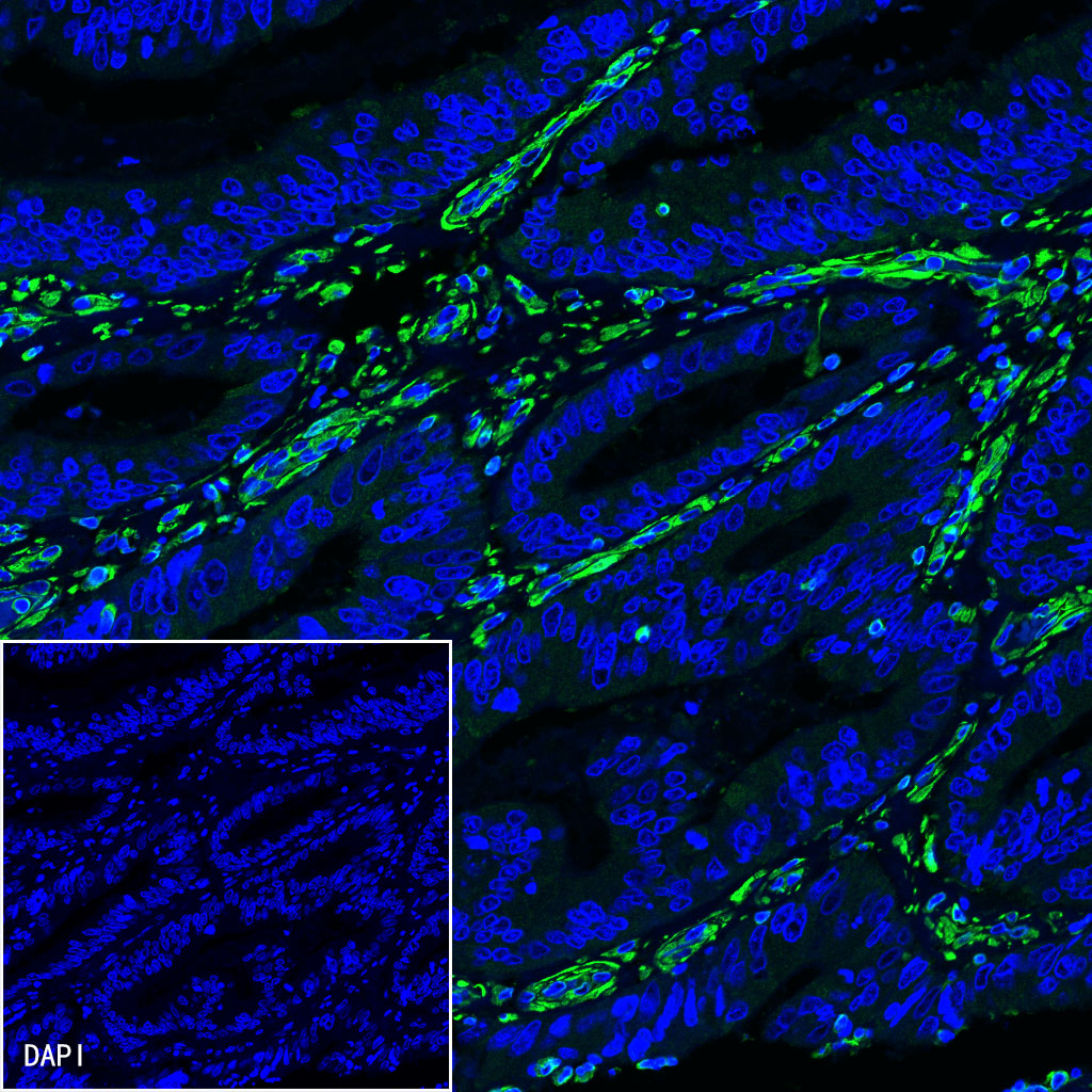 Rabbit anti-Vimentin Monoclonal Antibody(029-20)